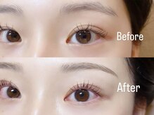 シュシュ(chou chou)/