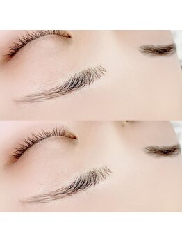 アルカナ 原宿表参道(ARCANA)/眉周りを綺麗に☆垢抜け☆