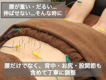 スプリング鍼灸院(Spring鍼灸院)/腰やお尻のコリや痛みに！