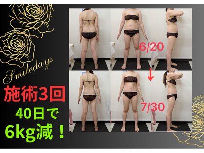 スマイルデイズ(Smiledays)の写真