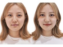 カラクル池袋/速攻垢抜けプラン