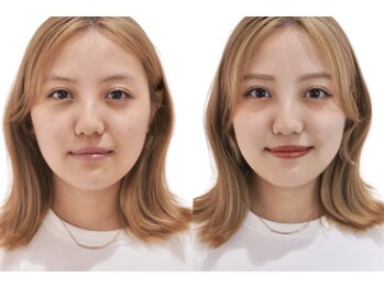 カラクル池袋/速攻垢抜けプラン