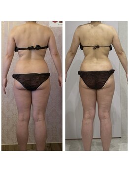 ルポーゼ(Repose)/