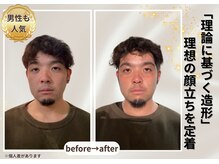 小顔美肌ファクトリー 梅田院の雰囲気（男性にも人気！男性セラピスト在籍。印象・清潔感・肌質UP!）