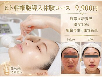 クリニカルエステ/イーズ パークプレイス大分店の写真/実力NO1！年齢による肌悩みやたるみ改善！ニキビケアにも◎【ヒト臍帯血幹細胞培養液70％導入コース￥9900】