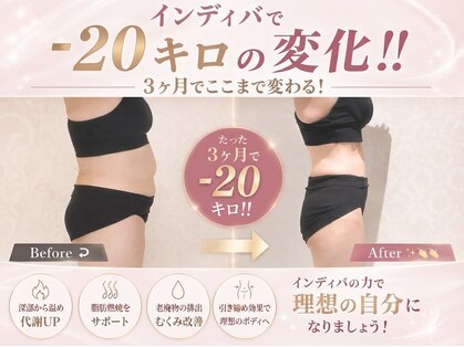 エステティック リオン(Rion)の写真