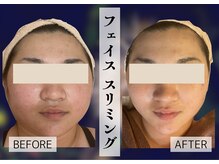 リヴェーヌ 富山店の雰囲気（大人気筋膜リリースから、お顔バージョンが新登場！輪郭スッキリ）