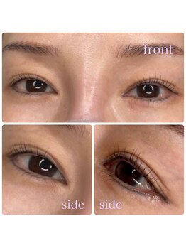 ヴァーチュープラス(VIRTUE PLUS)/