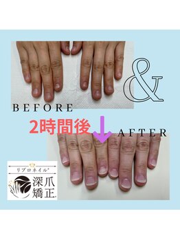 ブルームブルーム(BLOOMブルーム)/まるで自爪!?