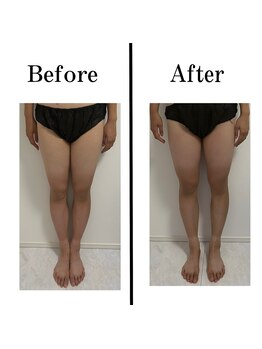 ワイドット(Y.)/ズボンがすんなり