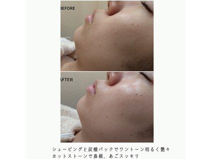 美ハッピーの写真