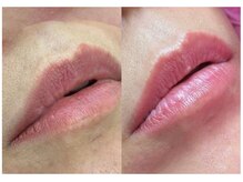 吉乃 大和高田有井店/ローマピンク【リップ】
