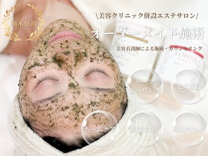 ウニ(uni)の写真