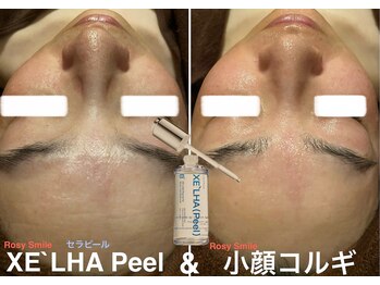 ロージースマイル(Rosy smile)/【韓国肌管理★ セラピール 】