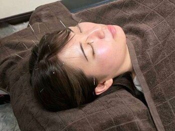 カンワ美容鍼灸院(KANWA美容鍼灸院)の写真/電気鍼で血行促進後に鍼をさし,お灸をするので普通のお灸よりも効果◎【頭痛撃退/眼精疲労改善】メニュー有