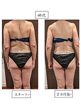 ローブメール(Robemail)/ビフォーアフター