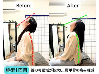 整体院 爽良/【札幌/大通り】首肩こり改善