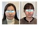 ラ ヴォワ 東銀座(La Voix)の写真