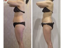 ルポーゼ(Repose)/