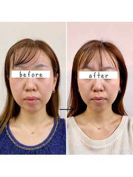 横浜DRT矯正院/小顔・美顔矯正