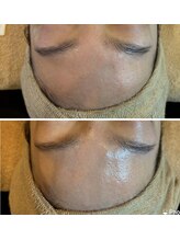 リレハウス(LileHouse)/ツヤ肌にはハーブがオススメ