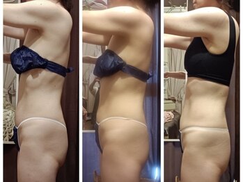 シャルマン(charmant)/グロッティプロ ボディ痩身