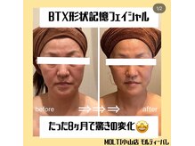 モルティーパレ(Molti Palais)/