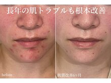 ハティア(hattia)の雰囲気（丁寧なカウンセリングが◎豊富な知識で健康美への近道を伝授♪）