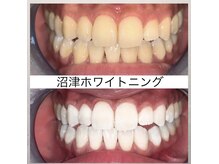 スタイリッシュビューティー(stylish beauty)の雰囲気（歯から人生を変えるホワイトニングサロン）
