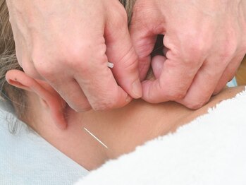 オーシャン鍼灸院の写真/「鍼灸は初めてで少し不安…」という方も◎気になる肩こりや腰痛等に対し鍼灸で体の内側からアプローチ。