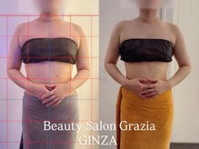 グラツィア 銀座(Grazia)/4回【 ブライダルエステ 】