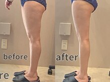 エスデザイン(es design)/下半身が気になる方