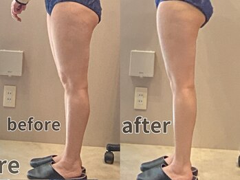 エスデザイン(es design)/下半身が気になる方