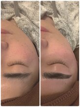 レーヴ(Reve)/【ブロウリフト】キレイな美眉に