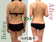 アムール(Amour)/肩甲骨出し｜30代女性