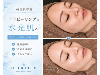 フルールドリス(FLEUR DE LIS)の写真/全顔・首・頭皮までトータルケア◎
【ララピール/ピーリング/韓国肌管理/毛穴ケア/美白ケア】