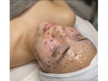 コモレビ(komorebi)の雰囲気（【毛穴引き締め&保湿効果】お悩み別に合わせたパックで鎮静）