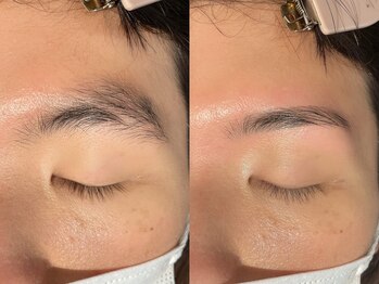 アイクイック 千石(Ai Quick)/メンズ眉毛/アイブロウ/千石/眉