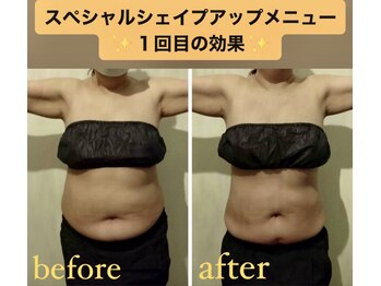 シェイプアップサロン/【Before&After】