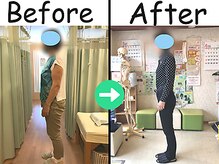 杉本接骨鍼灸院/【ダイエット】62歳でも10キロ