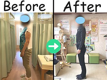 杉本接骨鍼灸院/【ダイエット】62歳でも10キロ