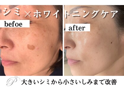 パールホワイトニングサロン 平塚店の写真