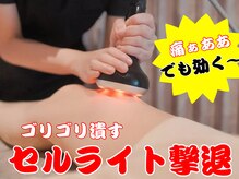 フェムビー(FemBe)