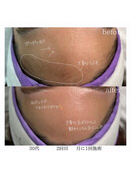 レオン(Leon)/ビフォーアフター