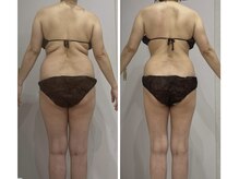 ルポーゼ(Repose)/