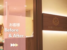 キレイサローネ 銀座ANNEX店(KIREI SALONE)/ ☆ビフォーアフターのご紹介☆