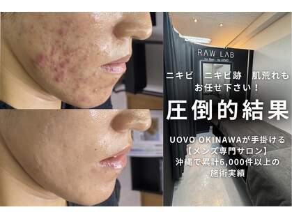 ラウラボ バイ ウォーヴォ(RAW LAB by UOVO)の写真