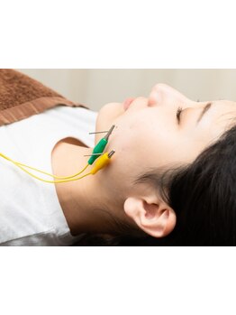 鍼灸施術を受けたい