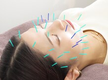 トゥービー(TWO-B)の雰囲気（お顔の美容鍼と身体の鍼を同時に出来る、大満足コースあり！）