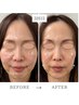 【リピーター様】たるみ改善×ツヤ肌速攻ケア!筋膜リフトアップ!
